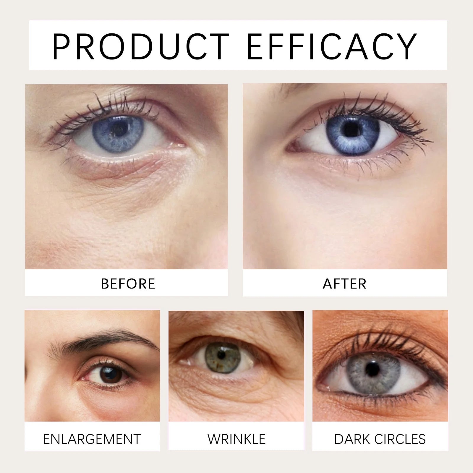Castor Oil Eye Serum Anti-wrinkle Remove Dark Circles Eye Bags Anti-puffiness Lift Firm Ball Massage Moisturize Nourish Eye Care