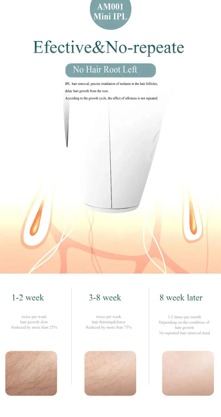 990,000 Flashes IPL Laser Hair Removal Device for Women, Painless Permanent Hair Remover for Home Use, Body, Bikini, and Face
