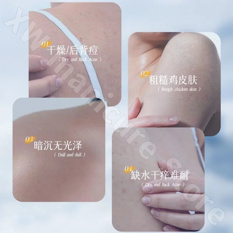 OHBT Brightening Body Lotion Nourishing Fruit Acids To Reduce Melanin Long-lasting Moisturizing Chicken Skin Removal 300ml