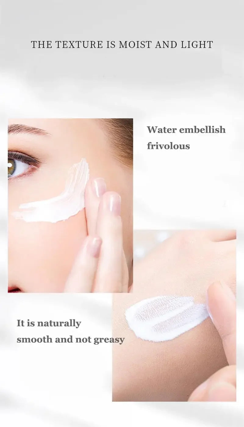 Powerful Spot-removing Whiten Cream Brighten Skin Fast Eliminates Melanin Pigmentation Melasma Dark Spots Moisturize Beauty Gel