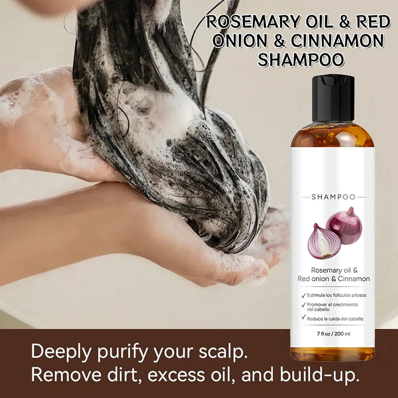 Rosemary Red Onion Hair Shampoo Deep Control Oil Cleanses The Scalp Enhance Hair Combability Nourish Moisturize Strengthen Hair
