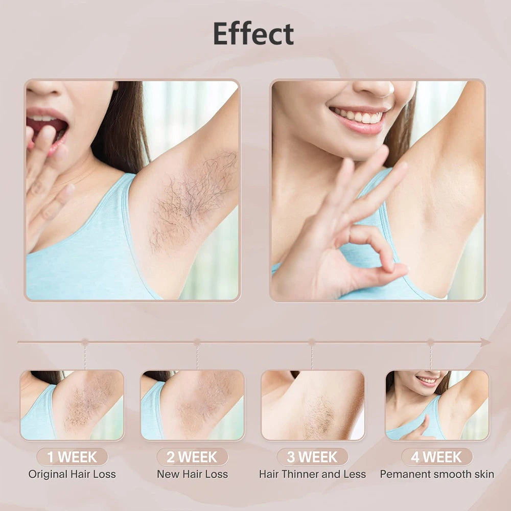 999999 Flashes Laser Epilator for Women Body Bikini Legs Armpit Arms Hair Removal Painless IPL Laser Permanent Electric Epilator