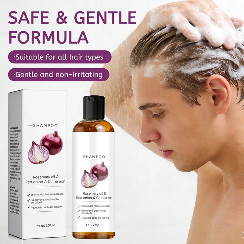 Rosemary Red Onion Hair Shampoo Deep Control Oil Cleanses The Scalp Enhance Hair Combability Nourish Moisturize Strengthen Hair