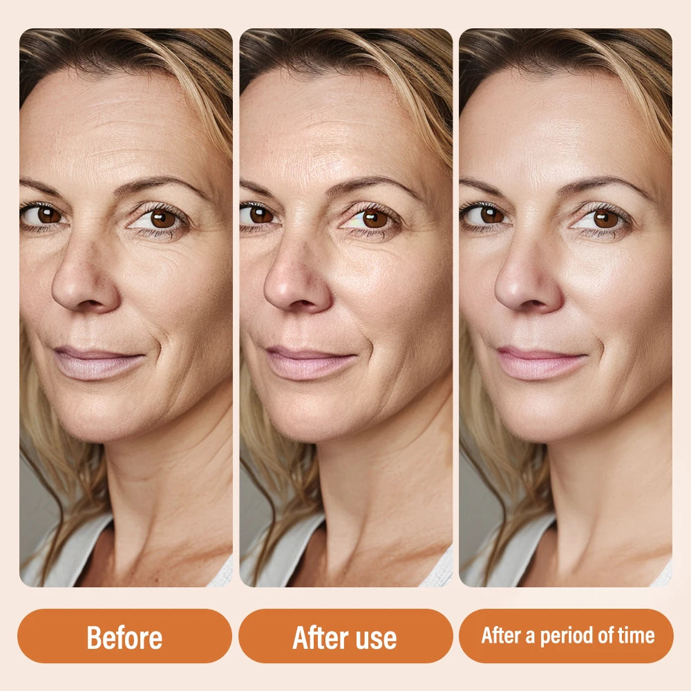 Super Vitamin C Serum for Face Dark Spot Remover for Face Skin Care Hyaluronic Acid Serum Targets Age Spots Hydrates and Wrinkle