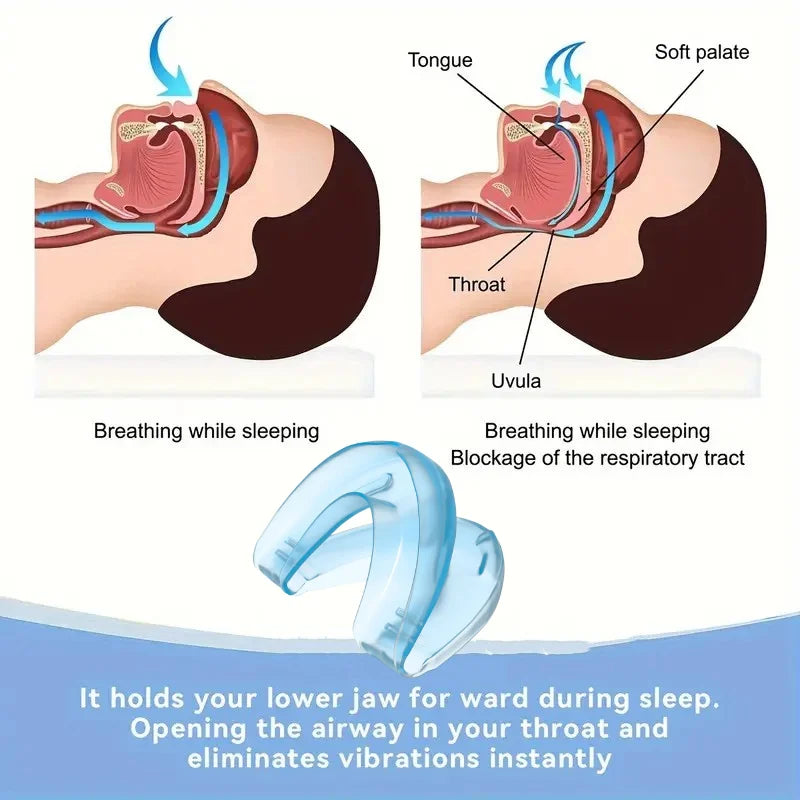 Mouth Guard Anti Snoring Soft Mouthpiece Comfortable Snoring Solution Adjustable Night Sleep Aid Bruxism Mouthpiece