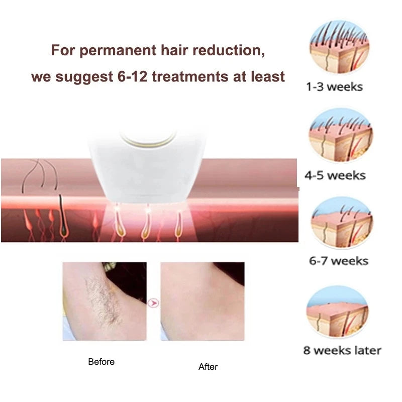 Laser Hair Removal At Home Semi-Permanent Laser Beauty Equipment Men And Women Whole Body Bikini Ipl Laser Hair Removal Epilator
