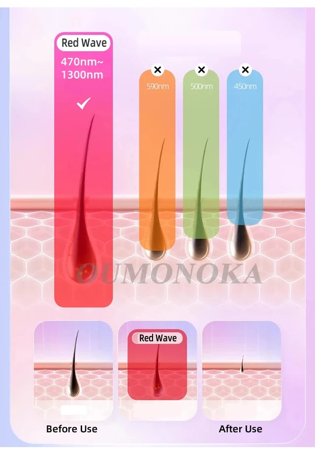 IPL Hair Removal Device 999999 Flashes Painless Laser Epilator for Women Permanent Hair Removal Home Use Body Bikini Face
