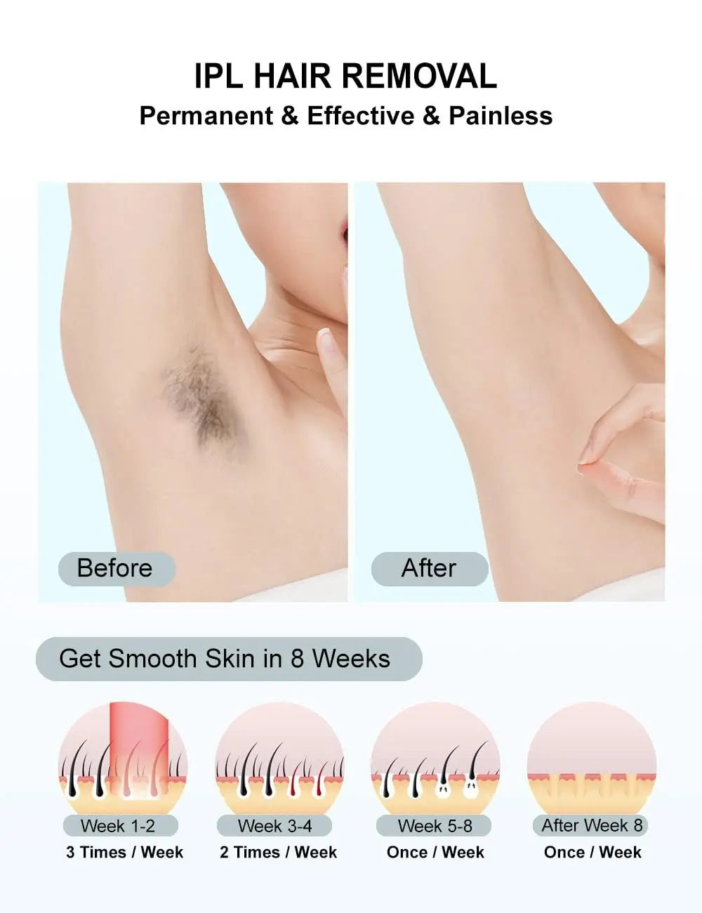 10  Beauty Care IPL Hair Removal Device 990000 Flashes Painless Permanent for Women Face Body Bikini LED Display Home Use
