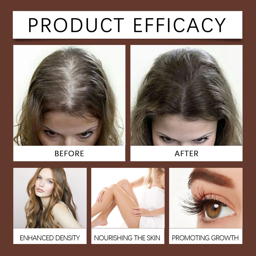 100ml Organic Castor Oil,Cold Pressed Unrefined Essential Oil For Hair Care Eyelash & Nail Growth Moisturizes Skin Hair Smoother