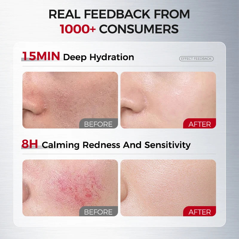100 ml Moisturizing & Calming Essence Lotion – HA + Ceramide for Dry, Redness‑prone Skin