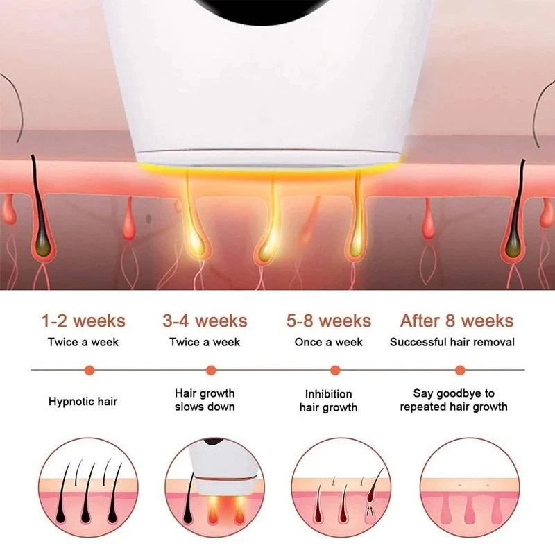 990,000 Flashes IPL Laser Hair Removal Device for Women, Painless Permanent Hair Remover for Home Use, Body, Bikini, and Face