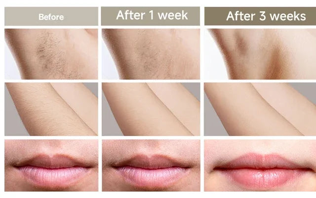 IPL Hair Removal Device 999999 Flashes Painless Laser Epilator for Women Permanent Hair Removal Home Use Body Bikini Face