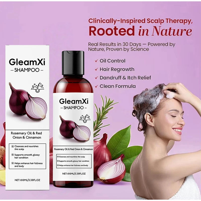 Rosemary Red Onion Hair Shampoo Deep Control Oil Cleanses The Scalp Enhance Hair Combability Nourish Moisturize Strengthen Hair