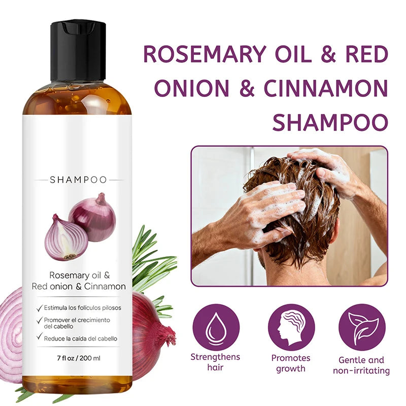 Rosemary Red Onion Hair Shampoo Deep Control Oil Cleanses The Scalp Enhance Hair Combability Nourish Moisturize Strengthen Hair
