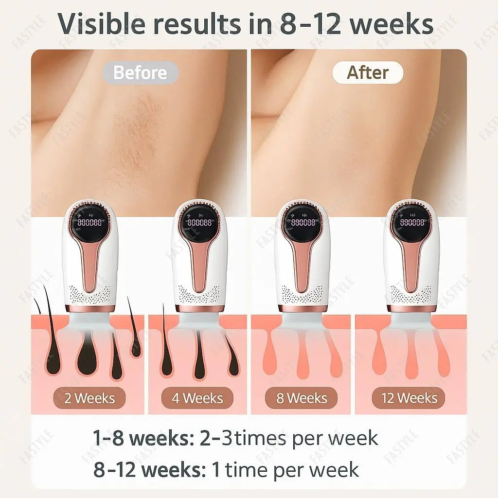 10  Beauty Care IPL Hair Removal Device 990000 Flashes Painless Permanent for Women Face Body Bikini LED Display Home Use