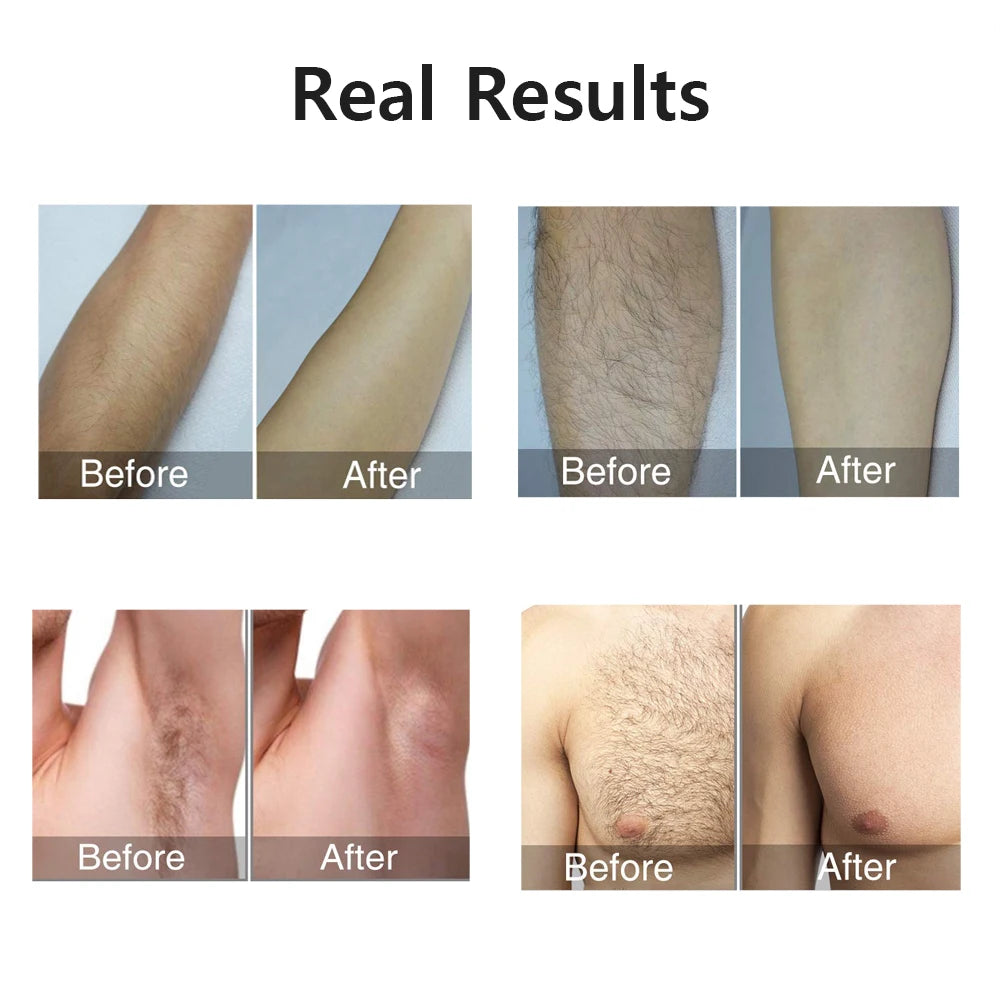 999999 Flashes Laser Epilator for Women Body Bikini Legs Armpit Arms Hair Removal Painless IPL Laser Permanent Electric Epilator