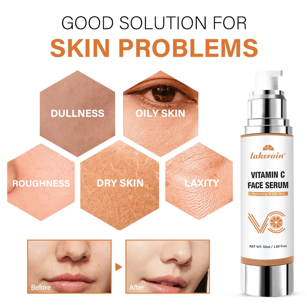 Super Vitamin C Serum for Face Dark Spot Remover for Face Skin Care Hyaluronic Acid Serum Targets Age Spots Hydrates and Wrinkle